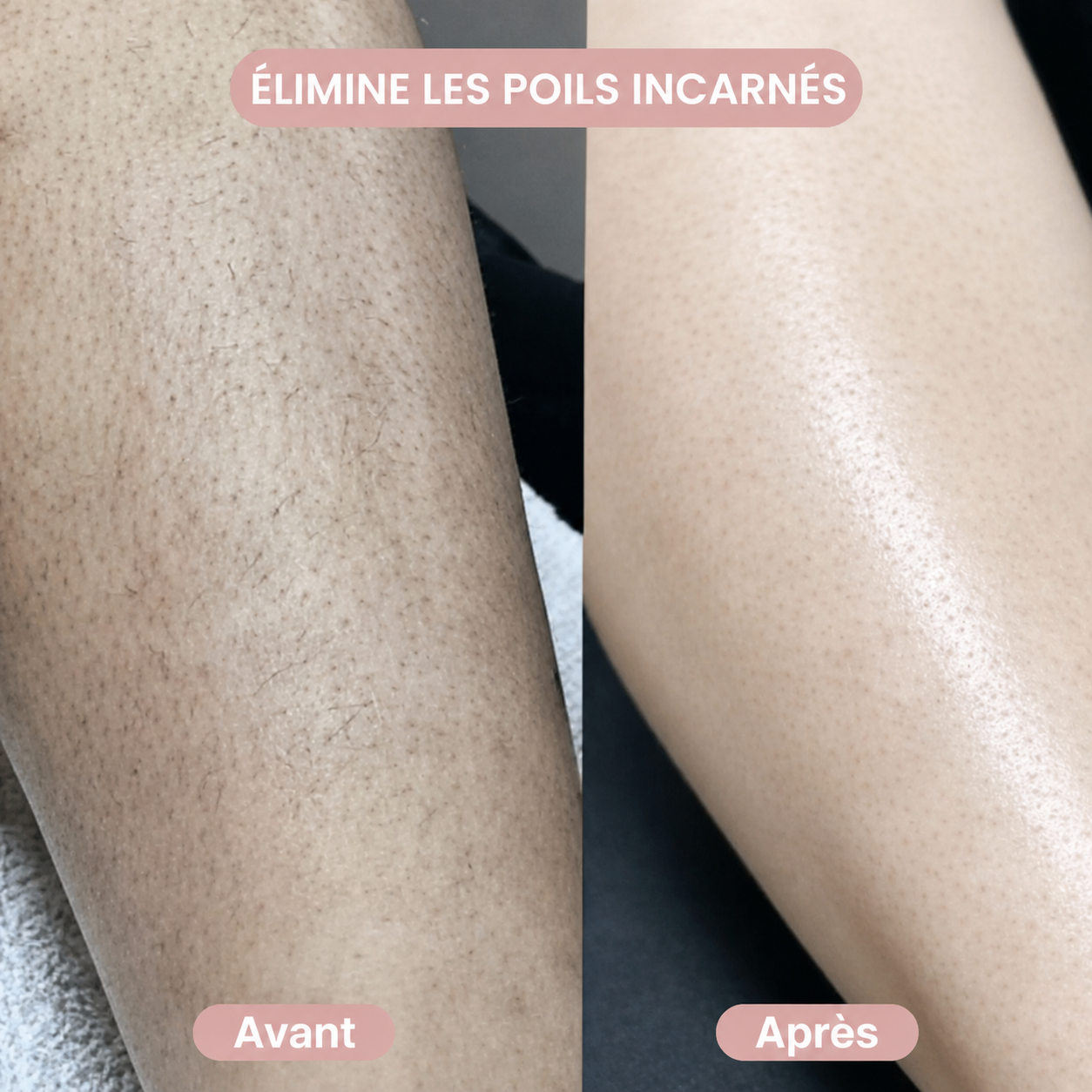 PureSkin™ Tondeuse 2-en-1 Corps & Maillot