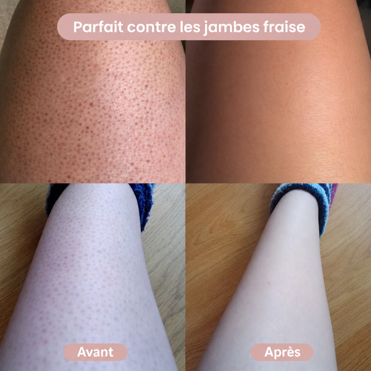 PureSkin™ Tondeuse 2-en-1 Corps & Maillot