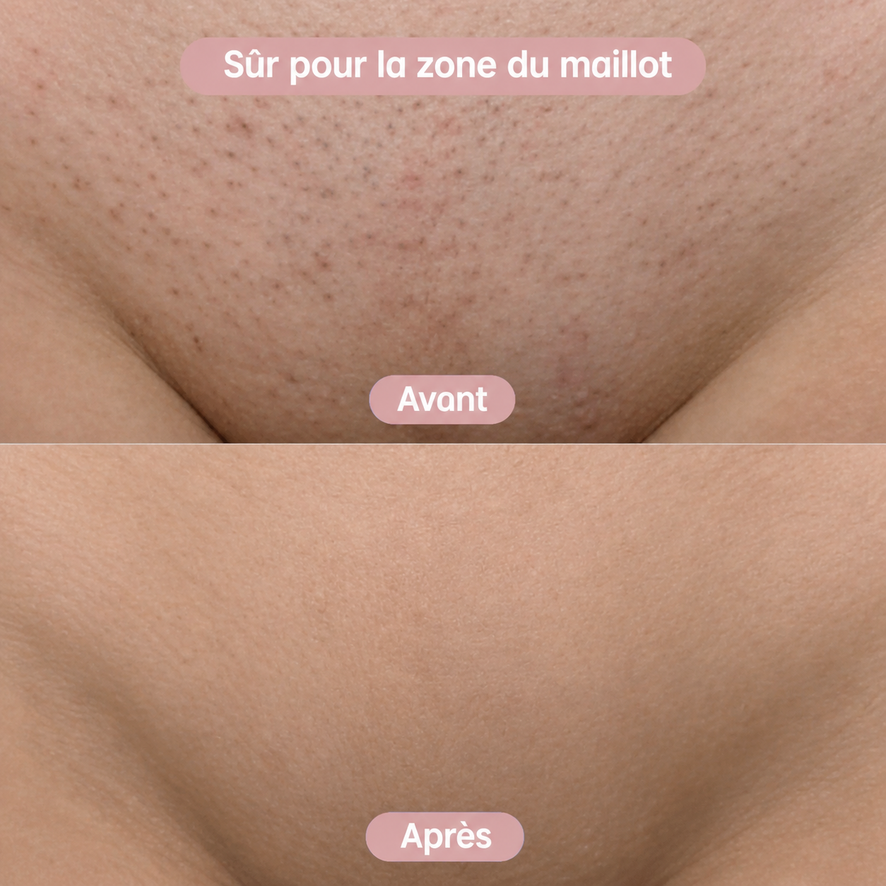 PureSkin™ Tondeuse 2-en-1 Corps & Maillot
