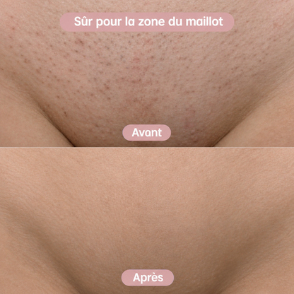 PureSkin™ Tondeuse 2-en-1 Corps & Maillot